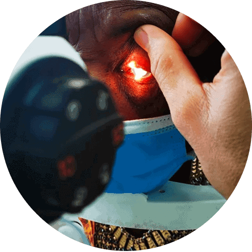 lutter contre la cecite terres d ophtalmo association d ophtalmologistes mission humanitaire